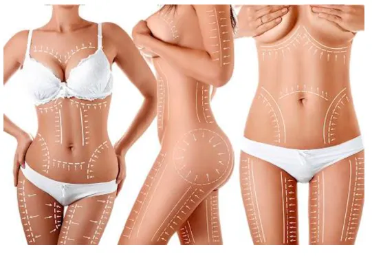 Avant/Après chirurgie plastique