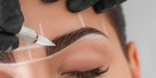 Injerto de cejas